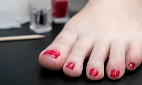 bild-fussnagelmodellage